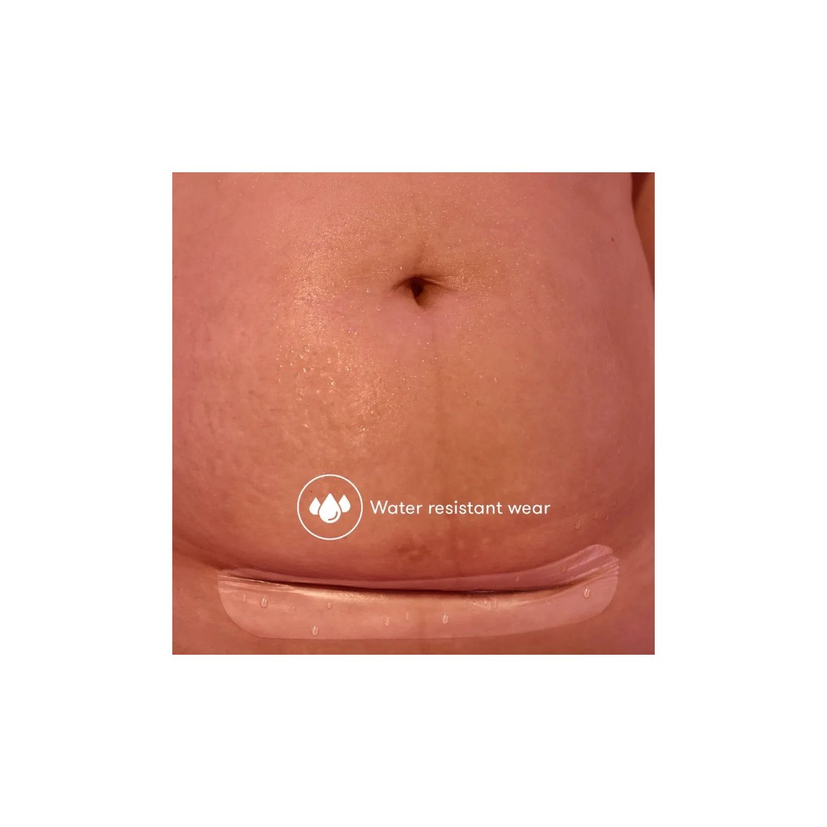 C-Section Silicone Scar Patches 6pk