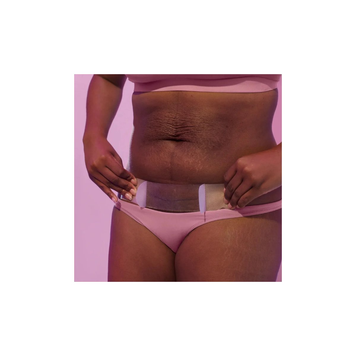 C-Section Silicone Scar Patches 6pk