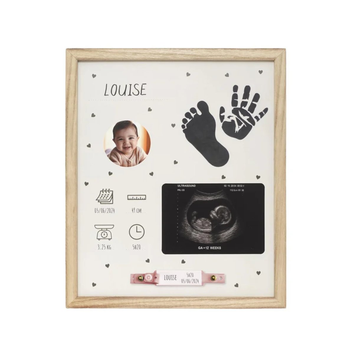 Birth Frame